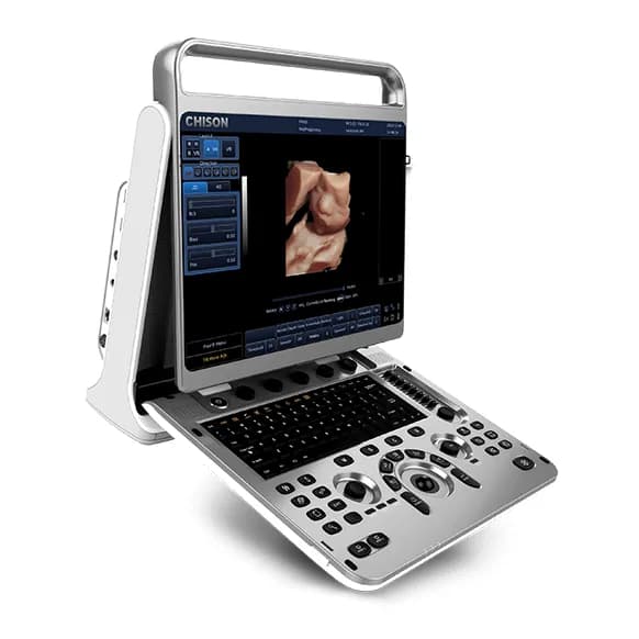 EBit 20 — Portativ ultratovush apparati