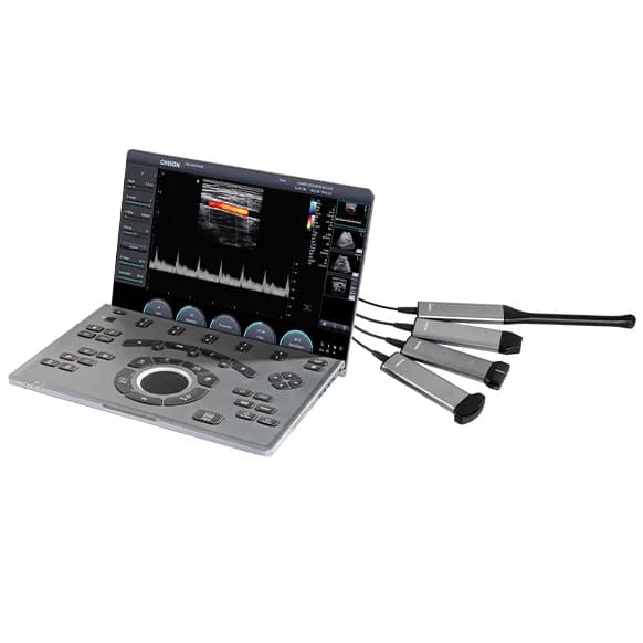 SonoAir 30 — Noutbuk turidagi ultratovush