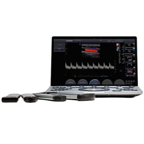 SonoAir 60 — Noutbuk turidagi ultratovush