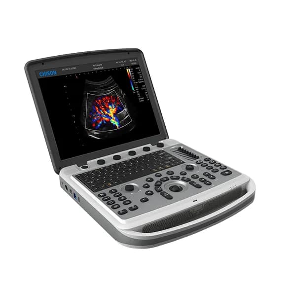 SonoBook 6 — Noutbuk turidagi ultratovush