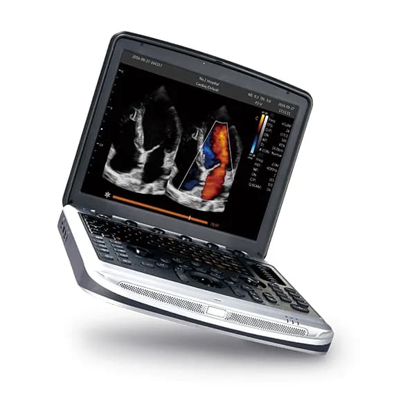 SonoBook 8 — Noutbuk turidagi ultratovush