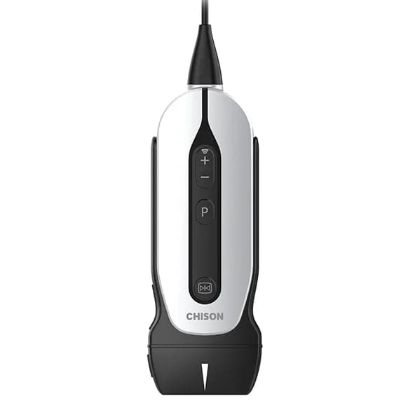 SonoEye P2 — Ultratovush datchigi