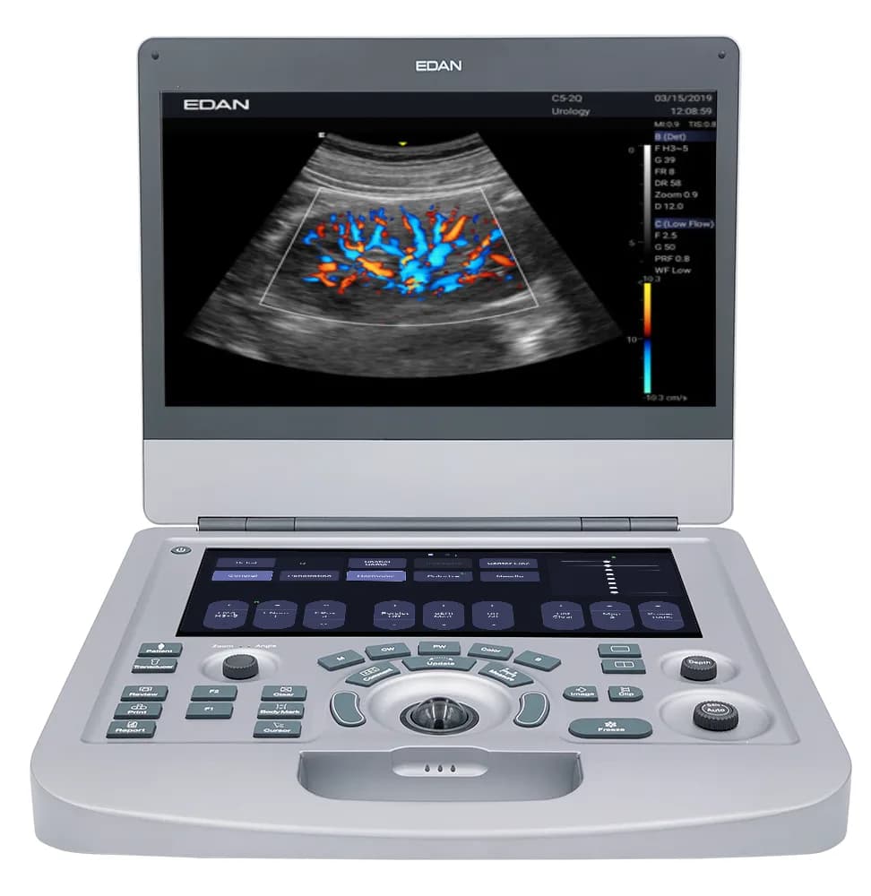 Acclarix AX2/AX3 Ultrasound — Ultratovush tizimi