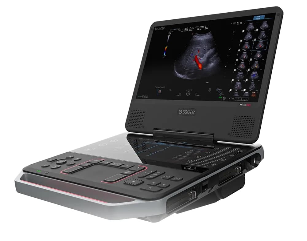 Esaote MyLab C25 — Ultratovush tizimi