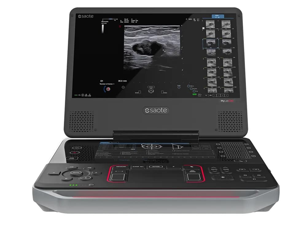Esaote MyLab C30 — Ultratovush tizimi