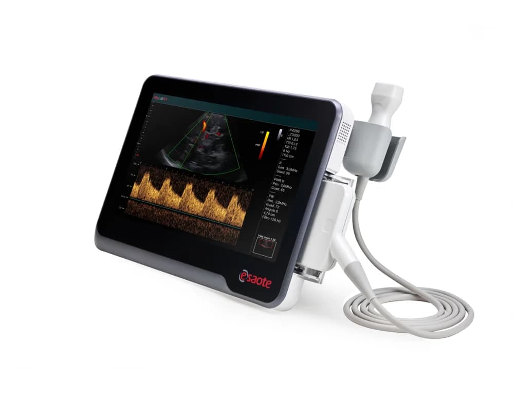 Esaote MyLab X1 — Ultratovush tizimi