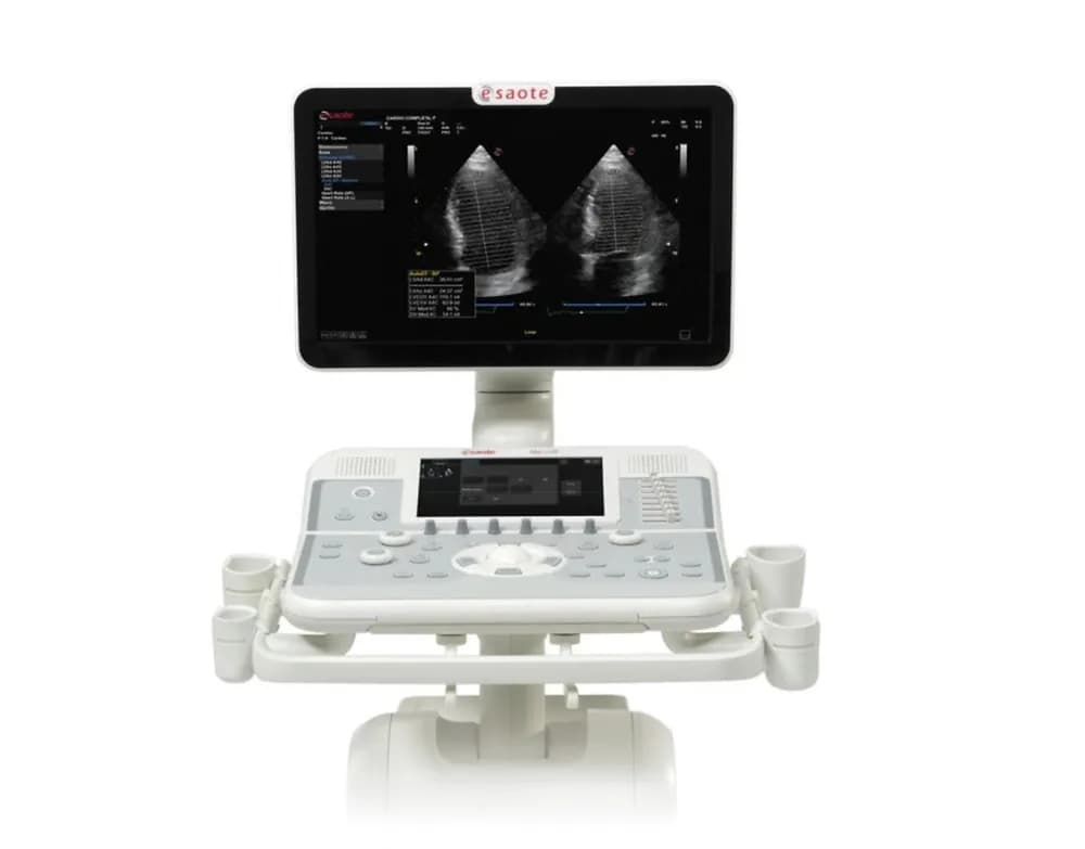 Esaote MyLab X5 — Ultratovush tizimi