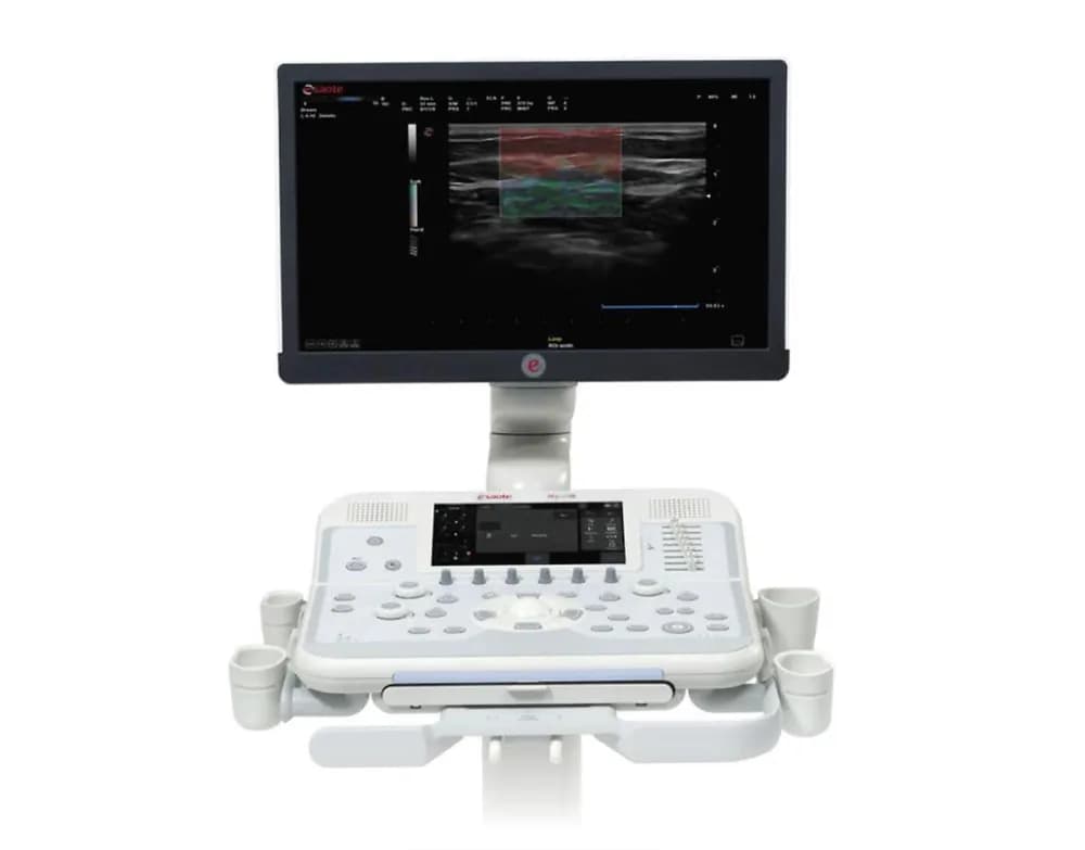 Esaote MyLab X6 — Ultratovush tizimi