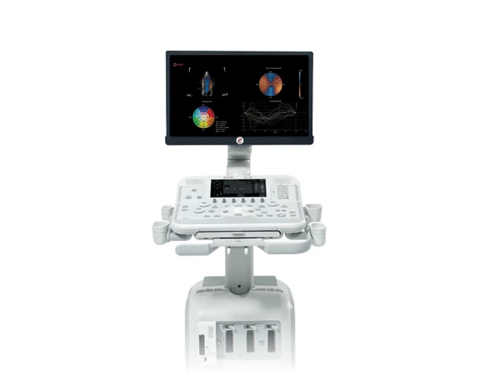Esaote MyLab X7 — Ultratovush tizimi