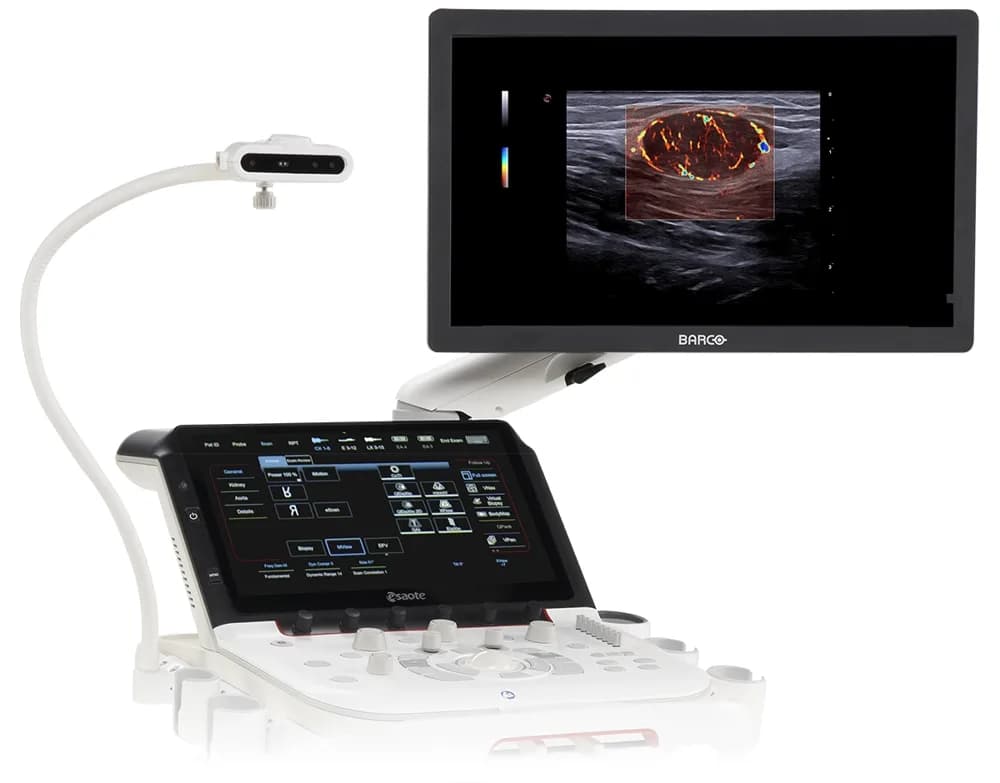 Esaote MyLab X90 — Ultratovush tizimi