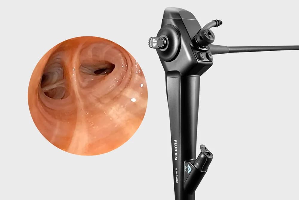 Fujifilm Bronchoscopes — Бронхоскопы