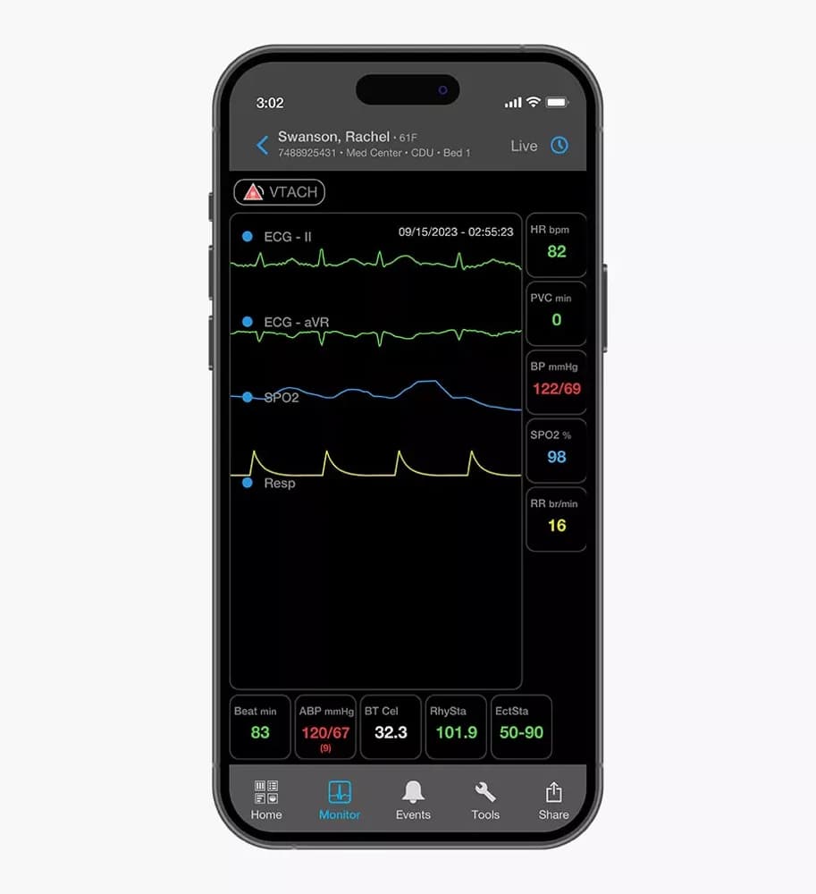 AirStrip surveillance and mobility solution — Bemor monitori