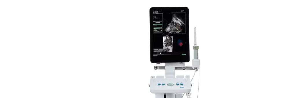 bkFusion–MRI-ultrasound Fusion Biopsy Solution — Ультразвуковая система
