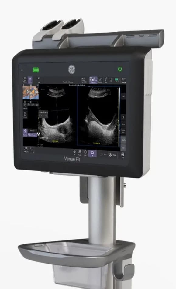 Venue Point of Care Ultrasound for Critical Care — Ultratovush tizimi