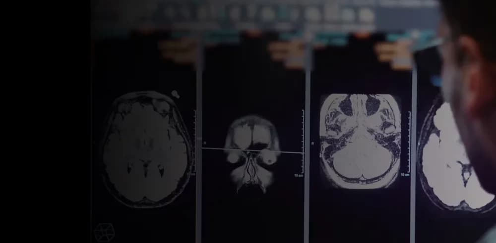 Upgrade to MR 30 for SIGNA MRI scanners — Магнитно-резонансный томограф