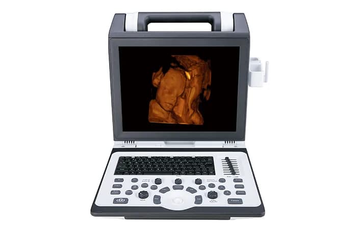 Apogee 2100 — Цветная доплеровская ультразвуковая система