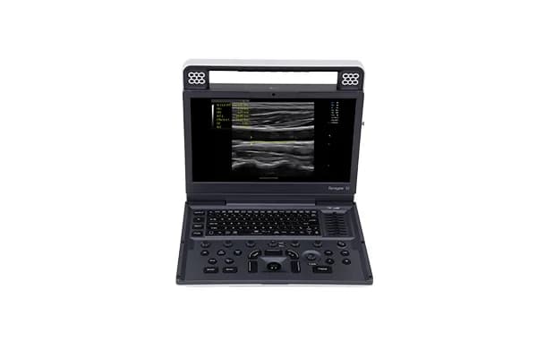 Apogee C1 — Цветная доплеровская ультразвуковая система
