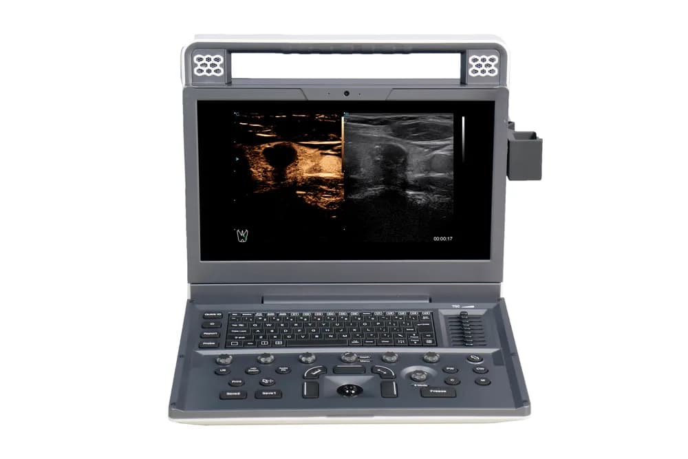 Apogee C2 — Цветная доплеровская ультразвуковая система