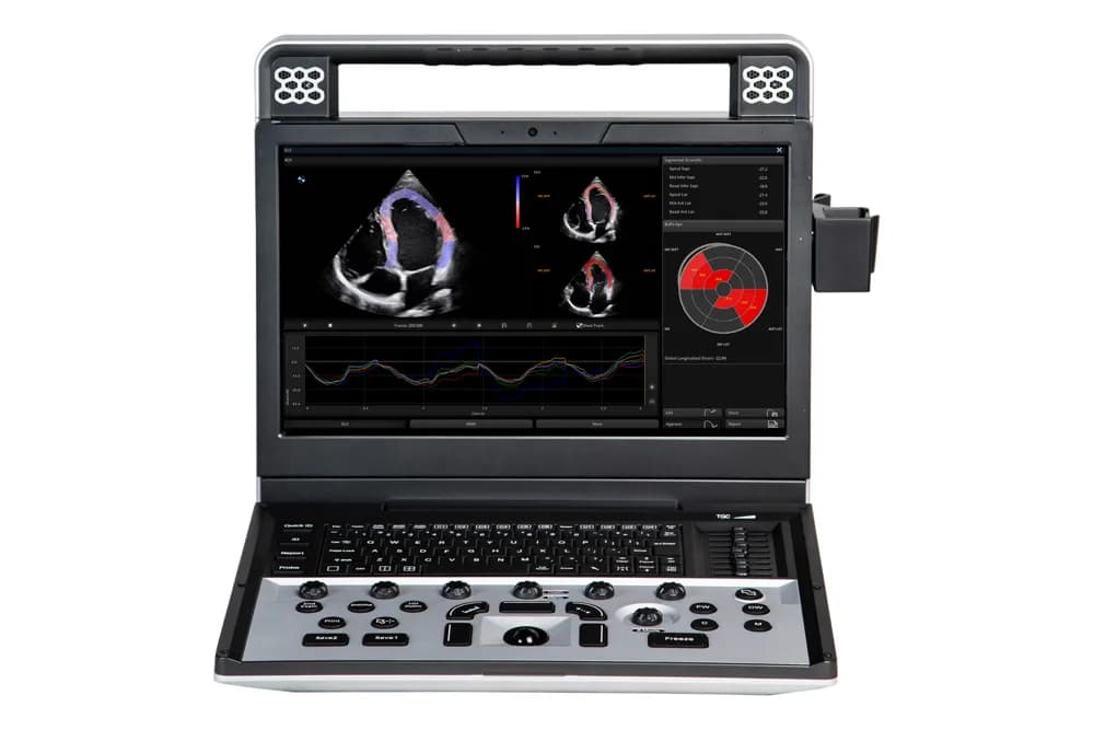 Apogee C5 — Цветная доплеровская ультразвуковая система