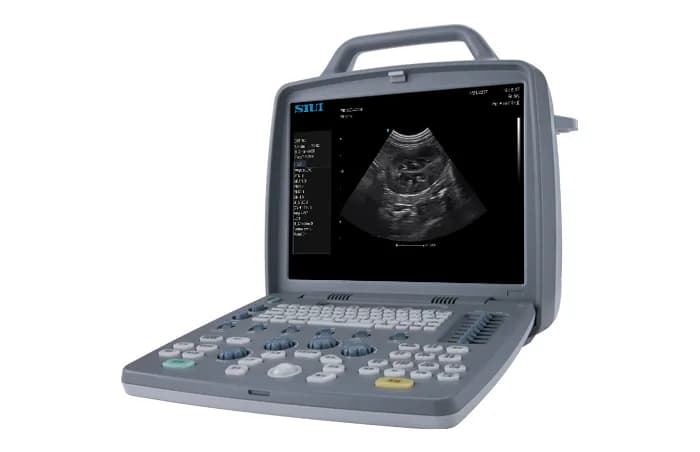 CTS-8800V Plus — Portativ ultratovush tizimi