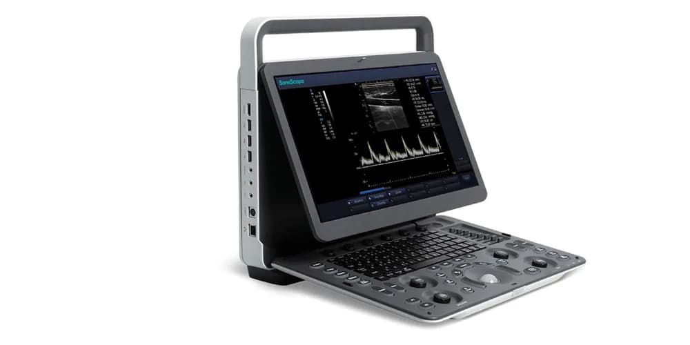 E1 — Ultratovush tizimi (B-rejim)