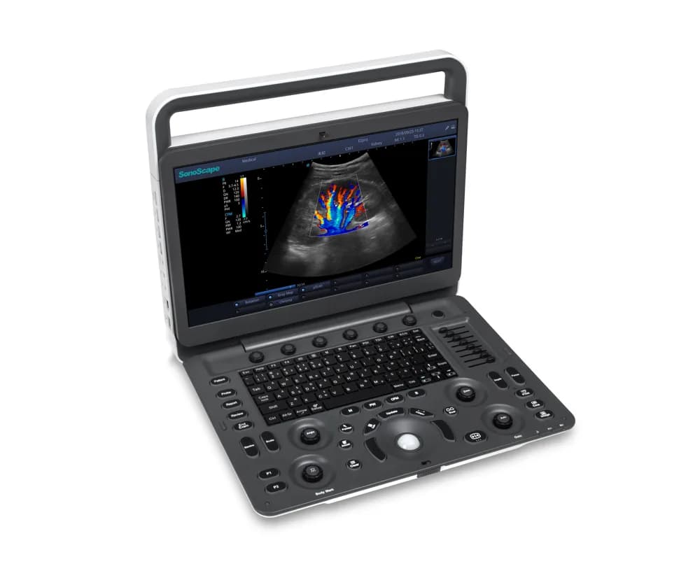 E2 Pro — Portativ ultratovush tizimi