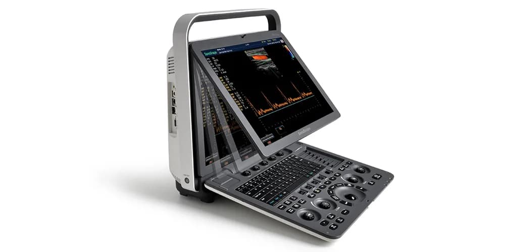 S8 Exp — Portativ ultratovush tizimi