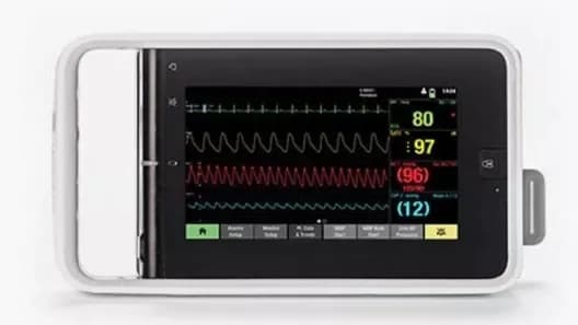 Neurological Patient Monitoring — Монитор пациента
