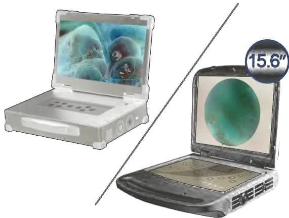 Портативная SD 900P эндоскопическая система HD-310