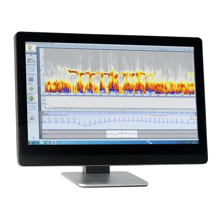 SCHILLER medilog DARWIN2 — Xolter monitoring tizimi
