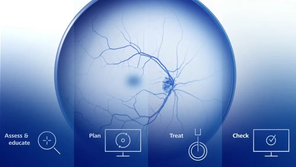 ZEISS VISULAS combi — Terapevtik lazer